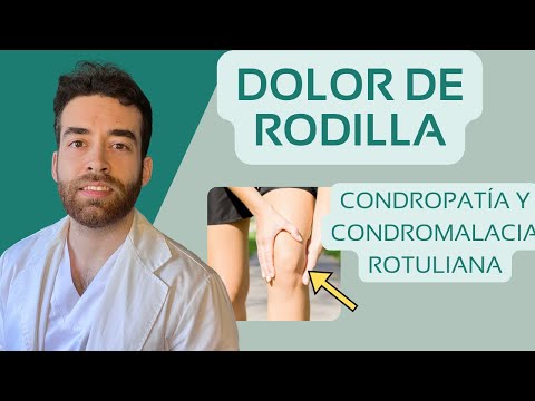 Dolor de rodilla y desgaste del cartílago🦵🏻🔥. CONDROPATÍA Y CONDROMALACIA ROTULIANA. Tratamiento para condropatía femorotibial interna grado 4
