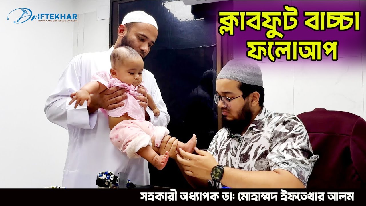 ক্লাবফুট বাচ্চা সম্পূর্ণ সুস্থ | Clubfoot Treatment by Dr.Iftekhar Alam 
