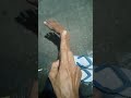 banyak koq yg lebih cepat lepas tongkat,yg penting niat semangat insyaallah cepet pulih lagi sehat