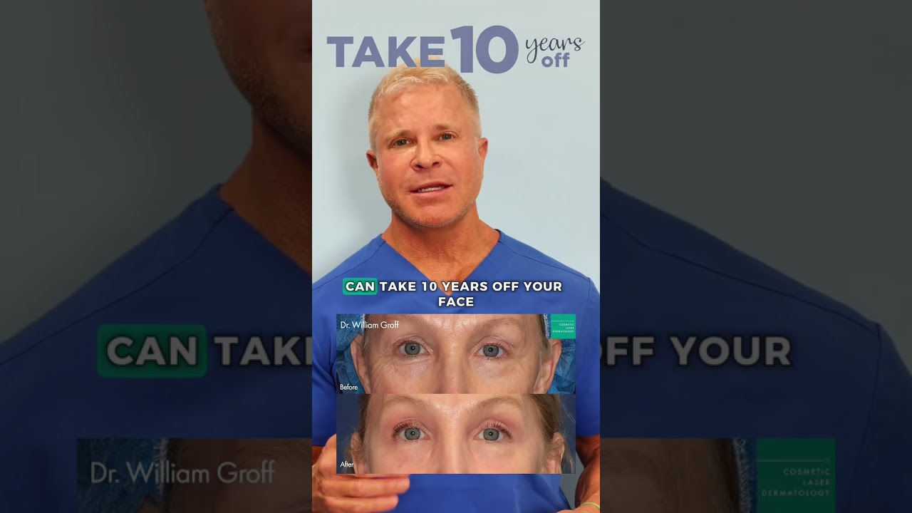 Banner for 💫 What if you could look 10+ years younger in one treatment — without surgery? #DrGroff #Webinar