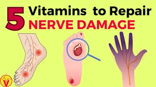 5 Vitamins For Nerve Damage Repair | Vitamins for Neuropathy | VisitJoy by VisitJoy 71,389 views 2 months ago 11 minutes, 30 seconds