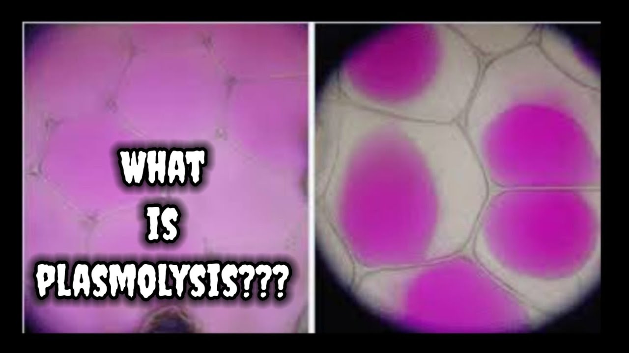 What is Plasmolysis??? a simple explanation 🥰