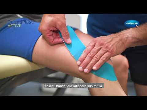 bandă kinesio pentru artrita genunchiului tratamentul artrozei articulațiilor interfalangiene ale mâinilor