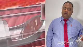 Co2 Laser Vaginal Tightening (Ageless Skin Clinic By Doctor Nuwan )