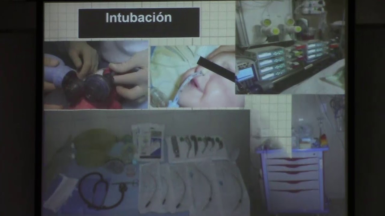 Cuidados de enfermería en neonatos con ventilación mecánica saludos amigos dvd