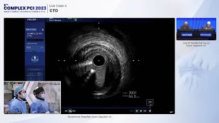 [COMPLEX PCI 2023] Live Case 4: CTO