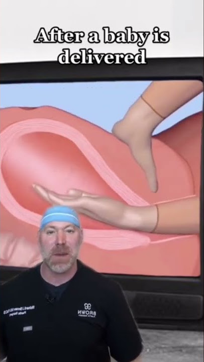 Removing a Placenta by Hand?! 😱 #shorts