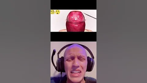 Life-changing surgery