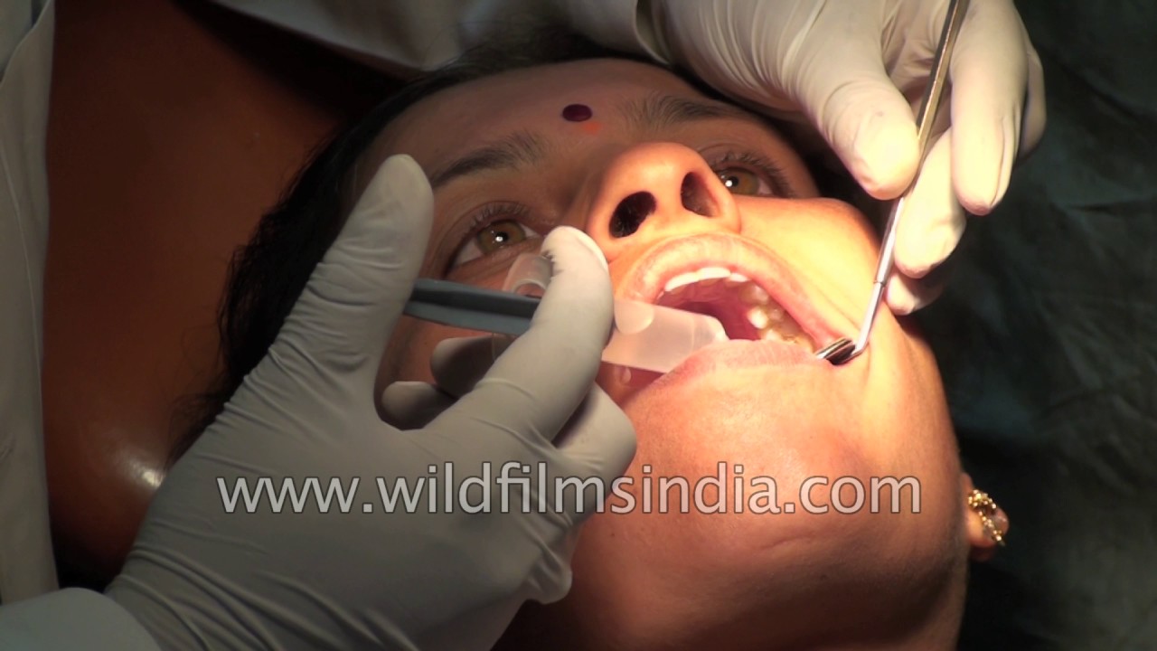Strange gestures and weird faces what dentists deal with during Dental