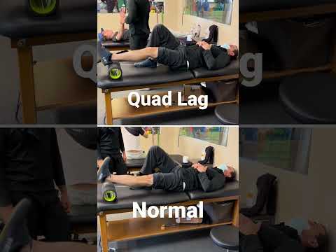 Quad Lag |