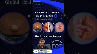 Live Ventral Hernia Examination | Real Patient Case Explained by Dr. Sanjeev Bhatia