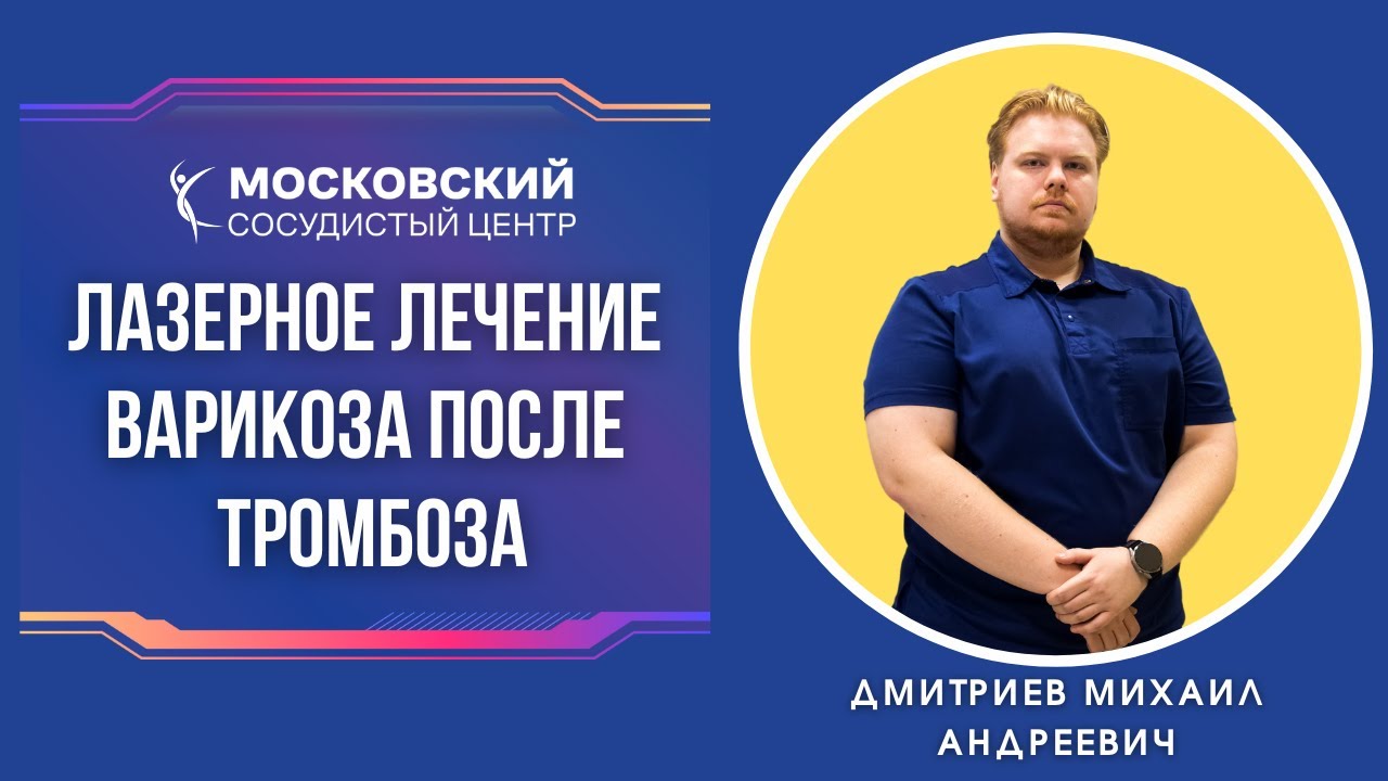Лазерное лечение варикоза после тромбоза г. Казань - YouTube
