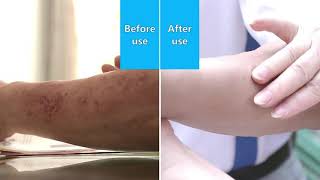 Yoxier Herbal Antibacterial Cream at Grosvenors Corner. screenshot 5