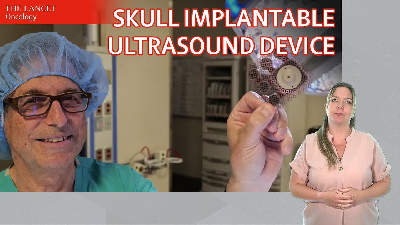 Repeated blood–brain barrier opening with an implantable ultrasound ...