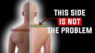 Uneven Shoulders? Don't Stretch It!