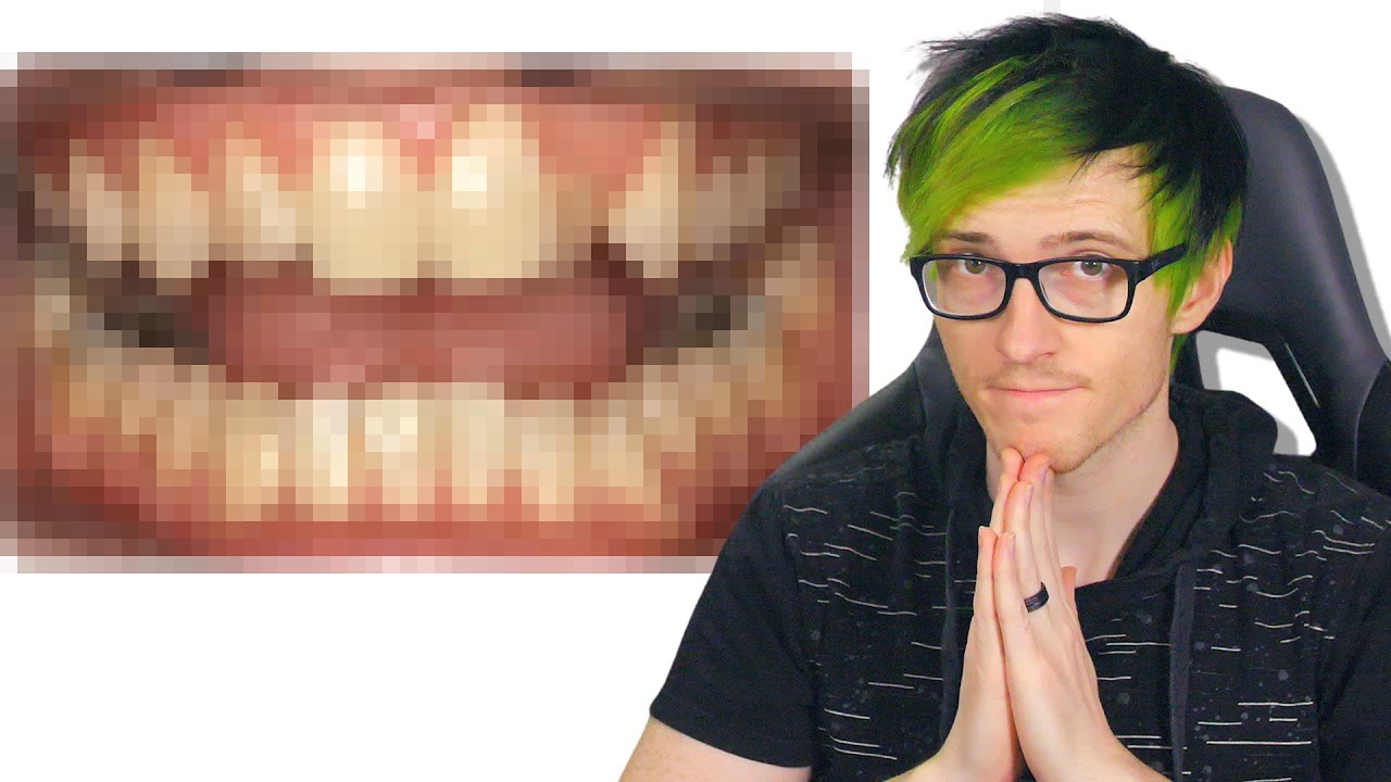 Im finally ready to talk about this