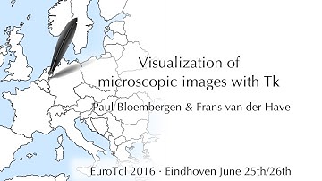 Visualization of microscopic images with Tk (Paul Bloembergen & Frans van der Have)