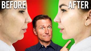 Fastest Way to Rid Your DOUBLE CHIN (Turkey Neck)