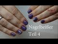 Nagelbeißer Teil 4