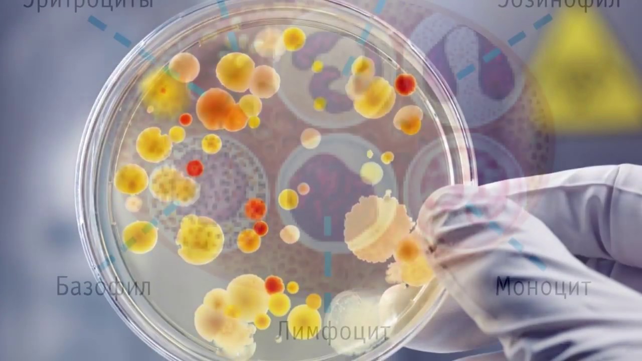 Анализы Крови: ДИФФЕРЕНЦИАЛЬНЫЙ АНАЛИЗ КРОВИ (нейтрофилы/базофилы/лимфоциты и моноциты)
