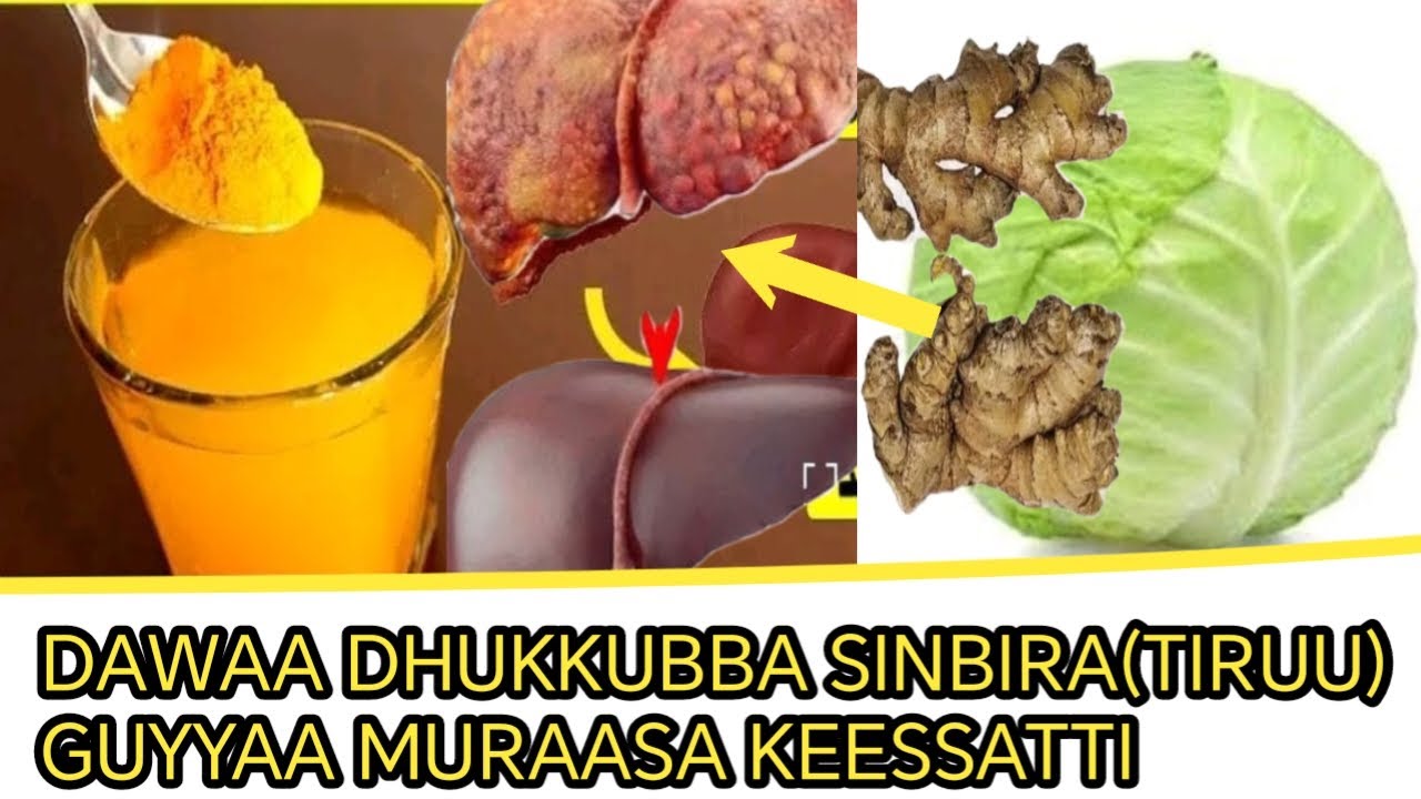 DAWAA DHUKKUBBA SINBIRA(TIRUU) GUYYAA MURAASA KEESSATTI