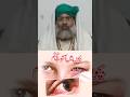 Quick and Easy Conjunctivitis HomeRemedies: Say Goodbye to Red Eyes! #shorts #pinkeye