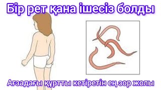 видео: Құрттарды үй жағдайында қалай емдеуге болады картинка: Құрттарды үй жағдайында қалай емдеуге болады
