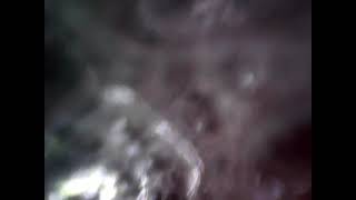 Endocam Stomach - Swallowed Mic