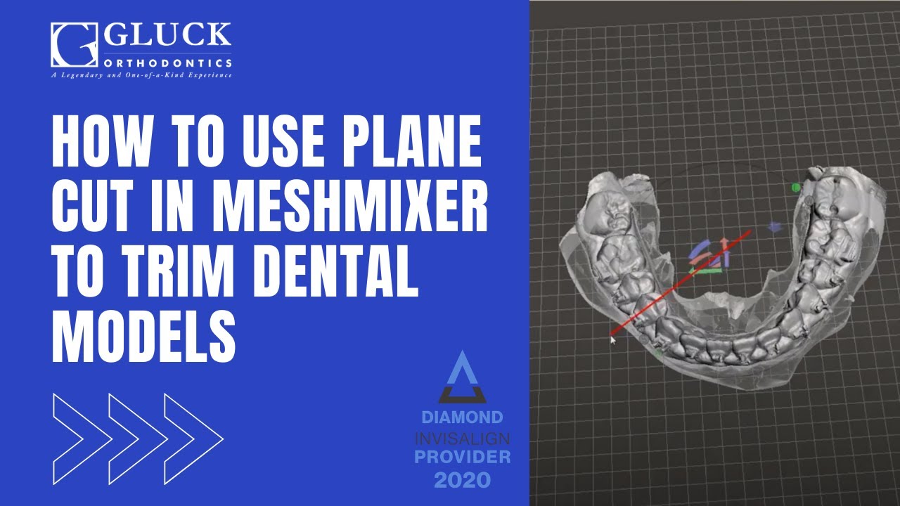 Using Plane Cut in MeshMixer to Trim Dental Models YouTube