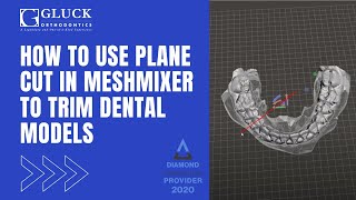 Using Plane Cut in MeshMixer to Trim Dental Models