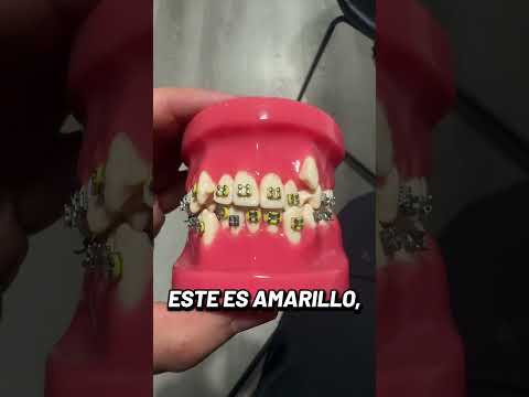 ¿Cual de estos colores de ligas te gustaría para tu próxima cita de brackets?? 😬