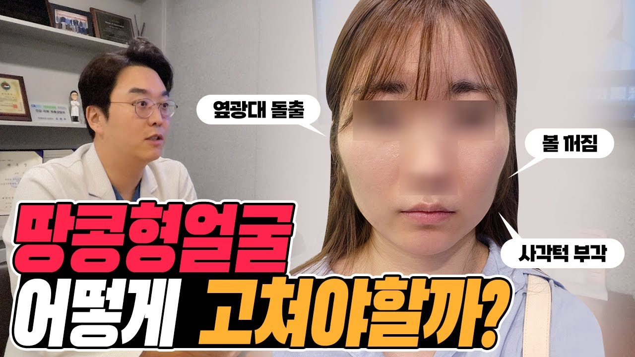 땅콩형얼굴 제대로 해결하는 방법 2편