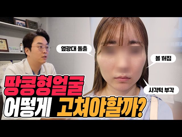 땅콩형얼굴 제대로 해결하는 방법 2편