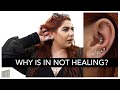 5 Reasons Why Your Earrings Are Not Healing