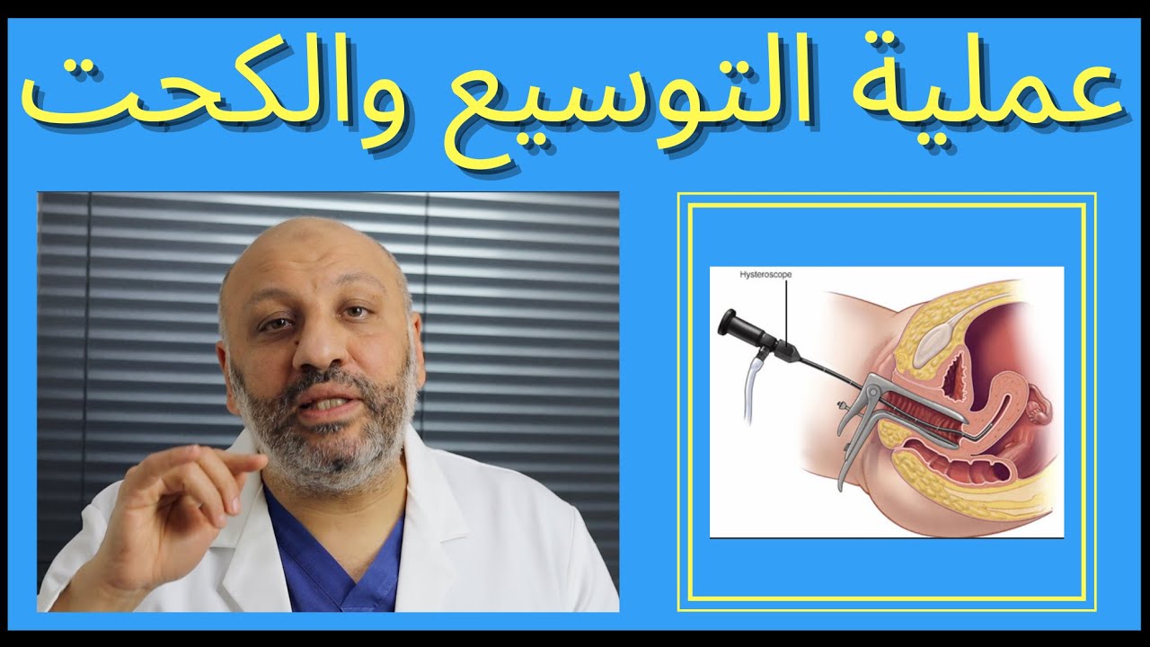 الحلقة (٦٩ ) عملية التوسيع والكحت