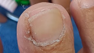 Pedicure Visit #satisfying Neldz SOLO Parent  is live!
