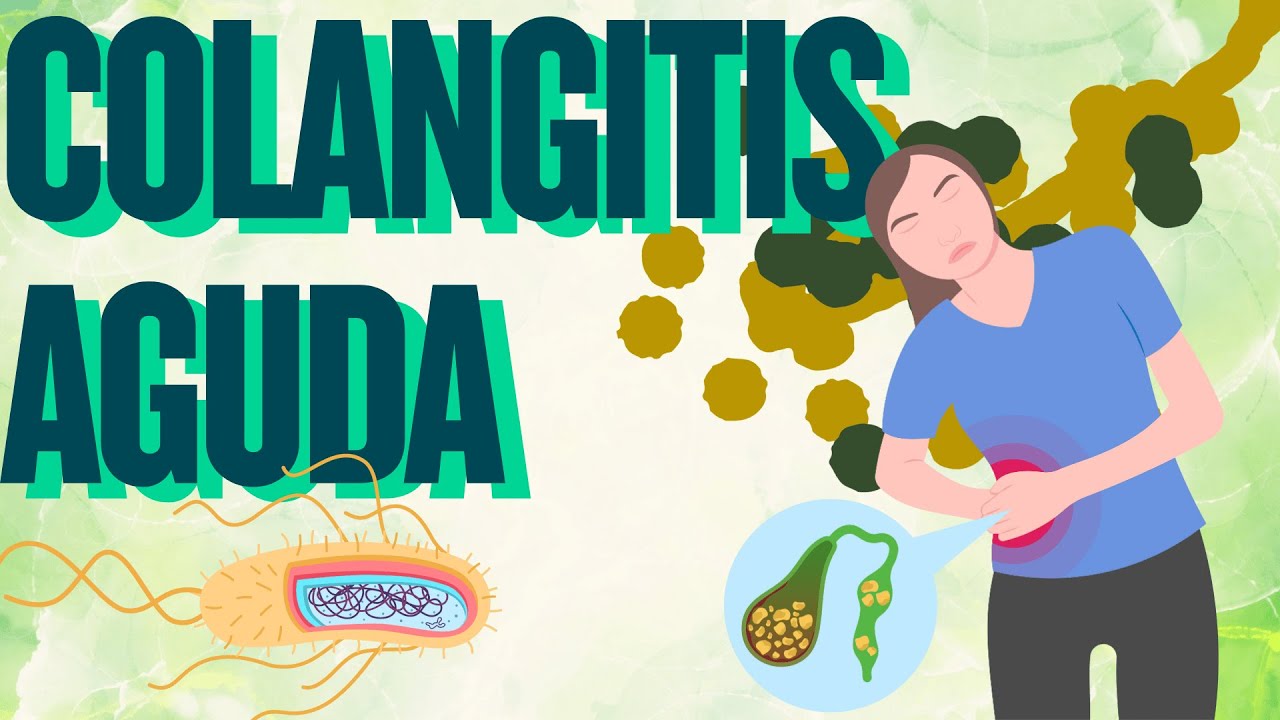 COLANGITIS AGUDA