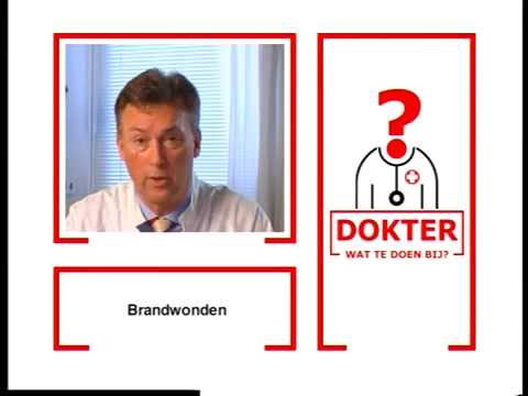 Dokter, wat te doen met brandwonden bij kinderen