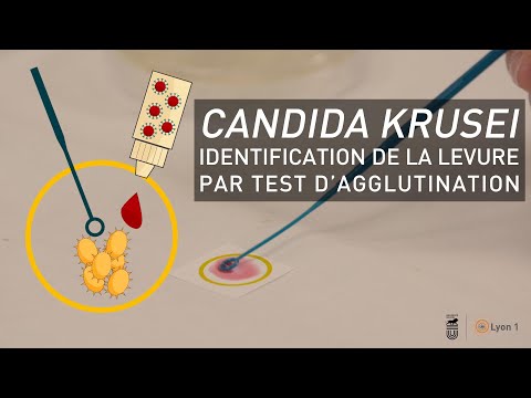 Candida Krusei : Identification de la levure par test d&rsquo;agglutination