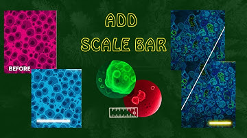 How to Add a Scale Bar to Microscopic Images | Step-by-Step ImageJ Guide