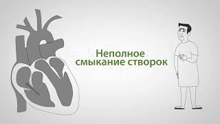 Видео Трикуспидальная недостаточность (автор: Webspital)