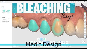 Bleaching trays with Medit Design App