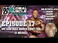 Shawn rhoden my jaw was wired shut for 12 weeks md global muscle clips s2 e17