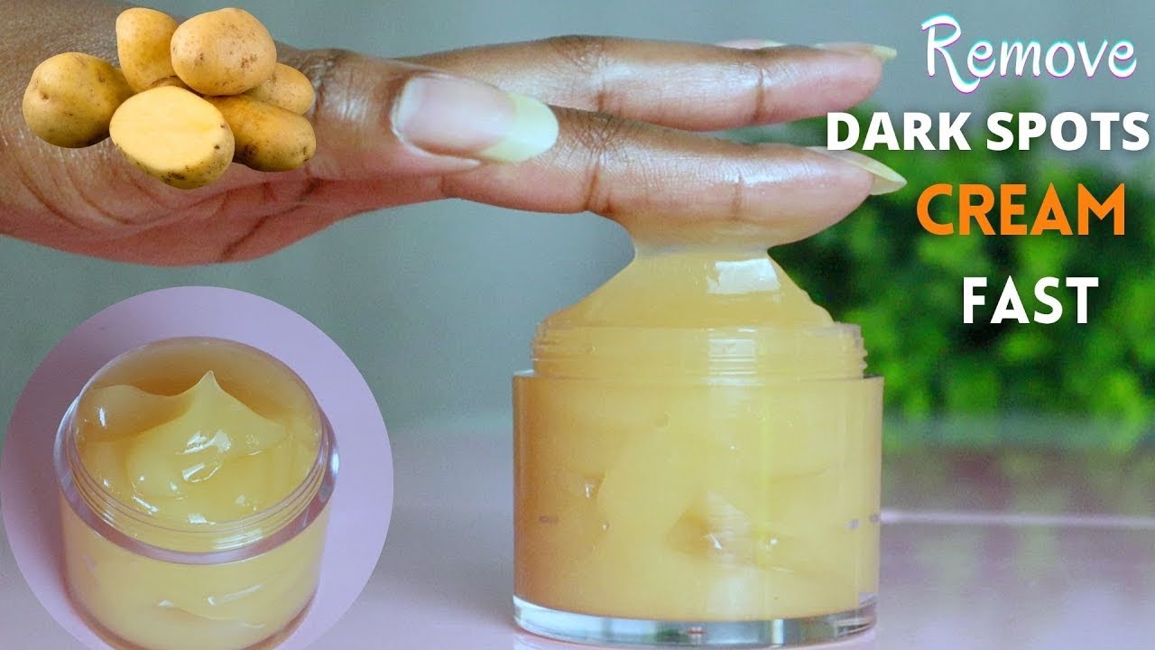 Best Homemade Cream For Dark Spots Dark Spots Removal Cream YouTube best-homemade-cream-for-dark-spots-dark-spots-removal-cream-youtube