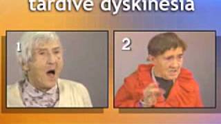 Tardive Dyskinesia video.avi