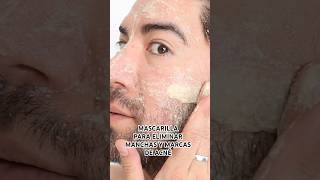 MASCARILLA PARA ELIMINAR ACNÉ Y MANCHAS