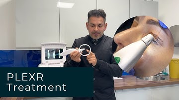 PLEXR Treatment: Everything You Need To Know | Dr Dev Patel