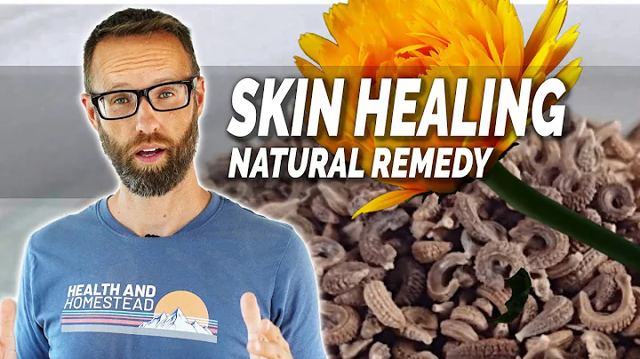 The Healing Powers of Calendula