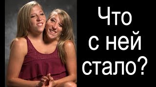 А У НАС БЫ ЕЁ СРАЗУ ЗАЛОШИЛИ. двухголовая девушка А У НАС БЫ ЕЁ СРАЗУ ЗАЛОШИЛИ. двухголовая девушка