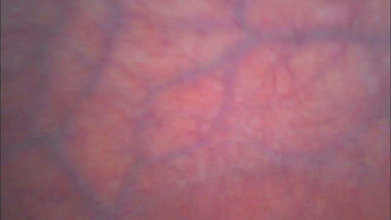 trying-to-see-the-entrance-of-my-stomach-in-reverse-and-duodenum-part